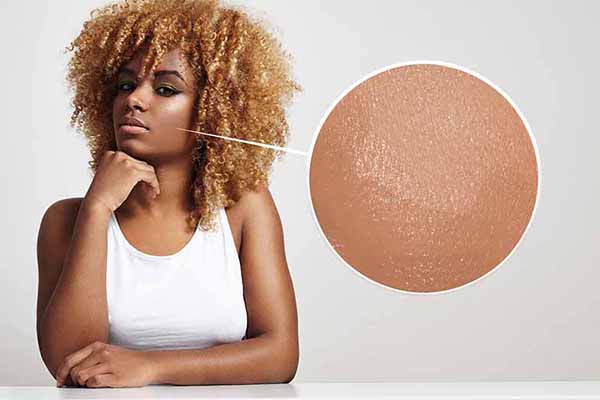 What Skin Type Do I Have? Here Is How To Tell