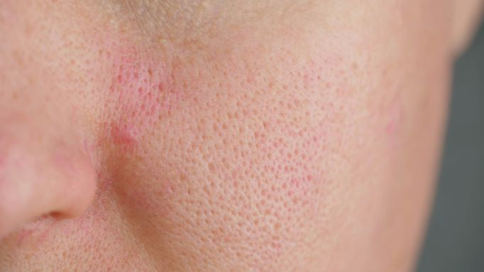How to Deep Cleanse Facial Pores