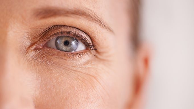 The Best Treatment for Under Eye Wrinkles