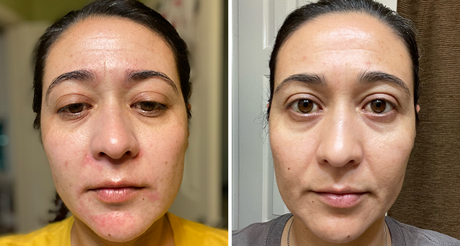 Customer face picture before and after